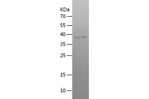 Western Blotting (WB) image for Wolfram Syndrome 1 (WFS1) (AA 148-311) protein (His-IF2DI Tag) (ABIN7125742)