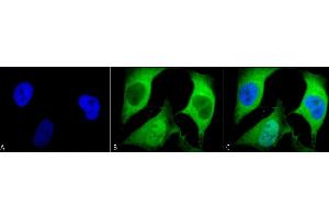 Immunocytochemistry/Immunofluorescence analysis using Mouse Anti-Ubiquitin Monoclonal Antibody, Clone 5B9-B3 (ABIN361810 and ABIN361811). (Ubiquitin anticorps)