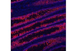 IF analysis of LI Cadherin/CDH17 using anti-LI Cadherin/CDH17 antibody (ABIN7600855). (LI Cadherin anticorps  (AA 24-695))
