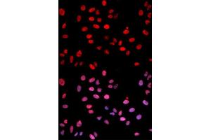 Immunofluorescence analysis of U2OS cells using Phospho-Jun-S243 antibody (ABIN5969907). (C-JUN anticorps  (pSer243))