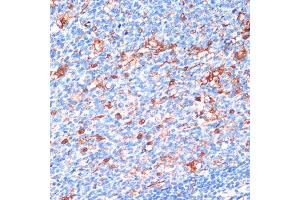 Immunohistochemistry of paraffin-embedded Human appendix using 14-3-3 alpha/beta antibody (ABIN3021284, ABIN3021285, ABIN3021286 and ABIN6214397) at dilution of 1:200 (40x lens).