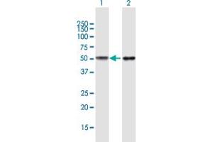 Western Blot analysis of TUBB4Q expression in transfected 293T cell line by TUBB4Q MaxPab polyclonal antibody. (TUBB7P anticorps  (AA 1-434))