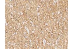 Immunohistochemical staining of human brain tissue using AP30096PU-N ATR antibody at 2 μg/ml.