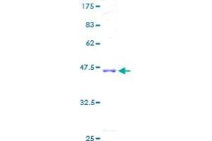 Image no. 1 for AarF Domain Containing Kinase 5 (ADCK5) (AA 1-169) protein (GST tag) (ABIN1305947)