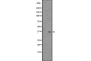 Western blot analysis of OR4C45 expression in HT1080 Whole Cell lysates ;,The lane on the left is treated with the antigen-specific peptide.