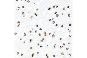 Immunohistochemistry of paraffin-embedded rat brain using HIST1H2BG antibody (ABIN6003628) at dilution of 1/100 (40x lens). (HIST1H2BG anticorps)