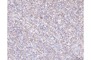 IHC analysis of ATX2/ATXN2 using anti-ATX2/ATXN2 antibody (ABIN3043507). (Ataxin 2 anticorps  (C-Term))