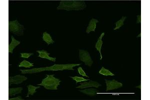 Immunofluorescence of monoclonal antibody to IDO1 on HeLa cell.