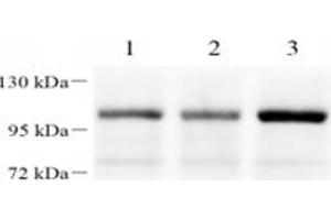 Western blot analysis of FOXK1 (ABIN7073970) at dilution of 1: 1000,Lane 1: HeLa cell lysate,Lane 2: 293T cell lysate,Lane 3: H1299 cell lysate (Foxk1 anticorps)