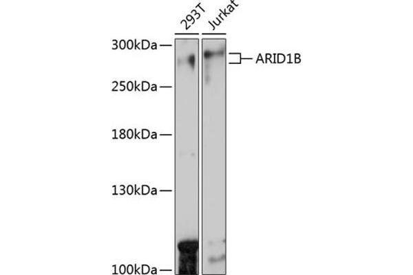 ARID1B anticorps  (AA 400-650)