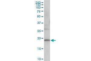Immunoprecipitation of DUSP22 transfected lysate using anti-DUSP22 MaxPab rabbit polyclonal antibody and Protein A Magnetic Bead , and immunoblotted with DUSP22 purified MaxPab mouse polyclonal antibody (B01P) .