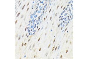 Immunohistochemistry of paraffin-embedded human esophageal using SLBP Rabbit pAb (ABIN7270590) at dilution of 1:100 (40x lens).