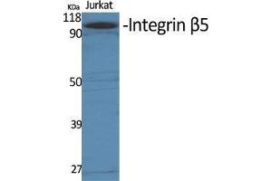 Western Blot (WB) analysis of specific cells using Integrin beta5 Polyclonal Antibody. (Integrin beta 5 anticorps  (C-Term))