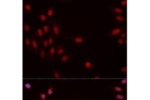 Immunofluorescence analysis of MCF-7 cells using Phospho-CHEK1(S317) Polyclonal Antibody (CHEK1 anticorps  (pSer317))