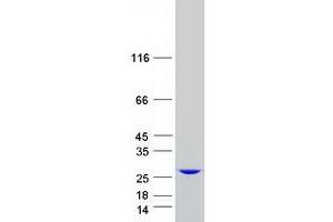 Validation with Western Blot