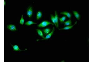 Immunofluorescence staining of A549 cells with ABIN7142296 at 1:133, counter-stained with DAPI. (HSD17B1 anticorps  (AA 2-261))