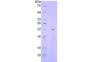 SDS-PAGE analysis of Human EGR1 Protein. (EGR1 Protéine)