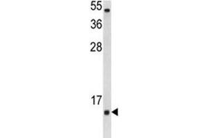 Western blot analysis of SOD1 antibody and Jurkat lysate. (SOD1 anticorps  (AA 55-84))