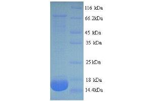 phospholipase A2, Group IIA (Platelets, Synovial Fluid) (PLA2G2A) (AA 22-146), (full length) protein (His tag)