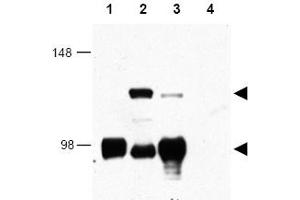 Image no. 1 for anti-CREB Regulated Transcription Coactivator 1 (CRTC1) (AA 19-34) antibody (ABIN401346) (CRTC1 anticorps  (AA 19-34))