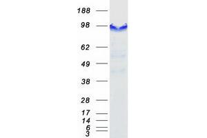 Validation with Western Blot