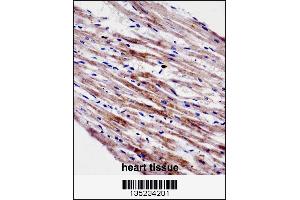 CTF1 Antibody immunohistochemistry analysis in formalin fixed and paraffin embedded human heart tissue followed by peroxidase conjugation of the secondary antibody and DAB staining.