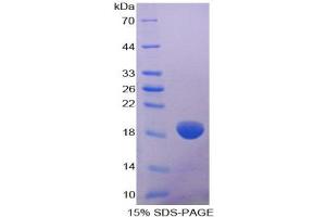 SDS-PAGE analysis of Human COL8A2 Protein. (COL8a2 Protéine)