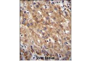 MIA40 Antibody (C-term) (ABIN655475 and ABIN2844998) immunohistochemistry analysis in formalin fixed and paraffin embedded human liver tissue followed by peroxidase conjugation of the secondary antibody and DAB staining. (CHCHD4 anticorps  (C-Term))
