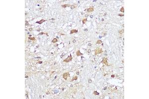 Immunohistochemistry of paraffin-embedded rat brain using Mu Opioid Receptor(MOR) Rabbit pAb (ABIN7269101) at dilution of 1:100 (40x lens).
