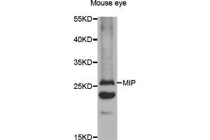 Western blot analysis of extracts of mouse eye, using MIP antibody (ABIN5971491) at 1:400 dilution. (MIP anticorps)