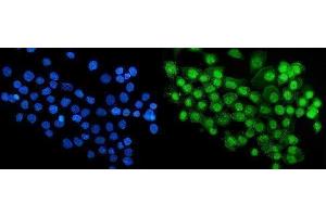 IF analysis of RBM47 using anti-RBM47 antibody (ABIN7602242). (RBM47 anticorps  (AA 66-317))