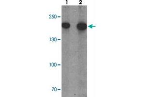 Western blot analysis of PHLPP1 in SW480 cell lysate with PHLPP1 polyclonal antibody  at (1) 1 and (2) 2 ug/mL. (PHLPP1 anticorps  (N-Term))