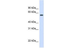Catalase antibody used at 1 ug/ml to detect target protein. (Catalase anticorps  (Middle Region))