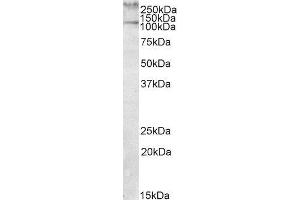 ABIN2560292 (1µg/ml) staining of Human Peripheral Mononucleocytes lysate (35µg protein in RIPA buffer). (TLN1 anticorps  (Internal Region))