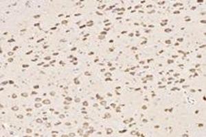 Immunohistochemistry analysis of paraffin-embedded rat substantia nigra using ST8SiaIII (ABIN7075721) at dilution of 1: 4000 (ST8SIA3 anticorps)