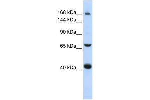 WB Suggested Anti-ABCC9 Antibody Titration:  0. (ABCC9 anticorps  (Middle Region))
