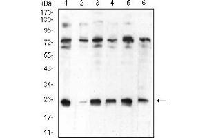 Western blot analysis using CBX5 mouse mAb against Hela (1), NIH/3T3 (2), K562 (3), MCF-7 (4), Jurkat (5), and A431 (6) cell lysate.