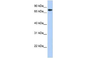 WB Suggested Anti-KLHL23 Antibody Titration: 0. (KLHL23 anticorps  (Middle Region))