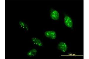 Immunofluorescence of purified MaxPab antibody to POLR1D on HeLa cell. (POLR1D anticorps  (AA 1-133))