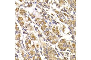 Immunohistochemistry of paraffin-embedded human stomach using METTL7B antibody (ABIN5974333) at dilution of 1/100 (40x lens). (METTL7B anticorps)