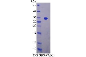 SDS-PAGE (SDS) image for CD163 (CD163) (AA 693-939) protein (His tag) (ABIN1878226)
