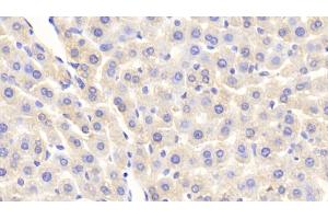 Detection of SAP in Rat Liver Tissue using Polyclonal Antibody to Serum Amyloid P Component (SAP)