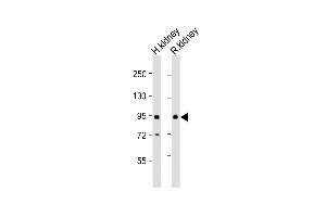 All lanes : Anti-SLC26A4 Antibody (C-Term) at 1:2000 dilution Lane 1: human kidney lysate Lane 2: rat kidney lysate Lysates/proteins at 20 μg per lane. (SLC26A4 anticorps  (AA 553-587))