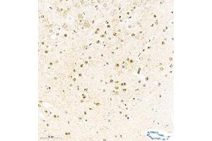 Immunohistochemistry analysis of paraffin embedded mouse brain using KCNIP3 (ABIN7073771) at dilution of 1: 2000 (DREAM anticorps)