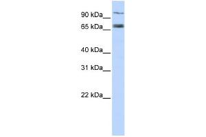 WB Suggested Anti-TAP1 Antibody Titration:  0. (TAP1 anticorps  (Middle Region))
