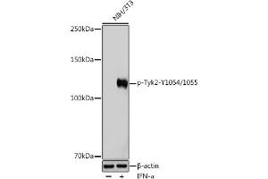 Western blot analysis of extracts of NIH/3T3 cells, using Phospho-Tyk2-Y1054/1055 Rabbit pAb (ABIN6135332, ABIN6136278, ABIN6136279 and ABIN6225571) at 1:1000 dilution. (TYK2 anticorps  (pTyr1054, pTyr1055))