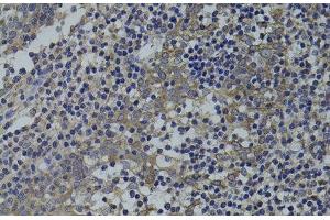 Immunohistochemistry of paraffin-embedded Human tonsil using GNA15 Polyclonal Antibody at dilution of 1:100 (40x lens). (GNA15 anticorps)