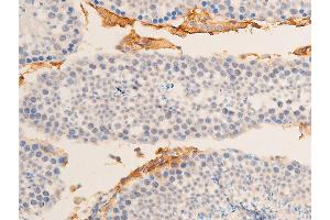 ABIN6267220 at 1/100 staining mouse testicular tissue sections by IHC-P.