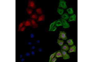Phospho-Nucleophosmin (Ser125) Antibody staining Hela cells(heat shock treatment) by IF/ICC. (NPM1 anticorps  (pSer125))
