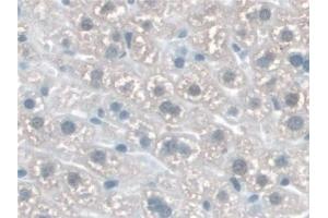 anti-Katanin P60 (ATPase Containing) Subunit A 1 (KATNA1) (AA 260-491) antibody